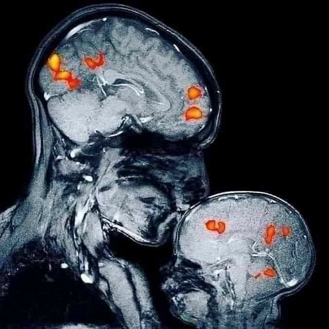 Turkish Slut Womans 34 arsivizm gallery