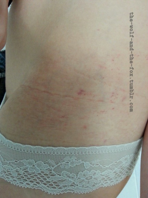 The Wolf and The Fox