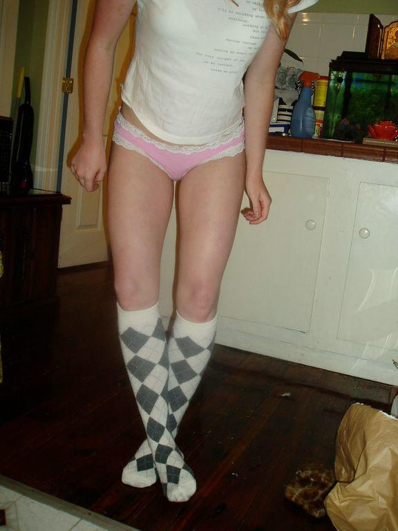 Freckled Redhead Strips