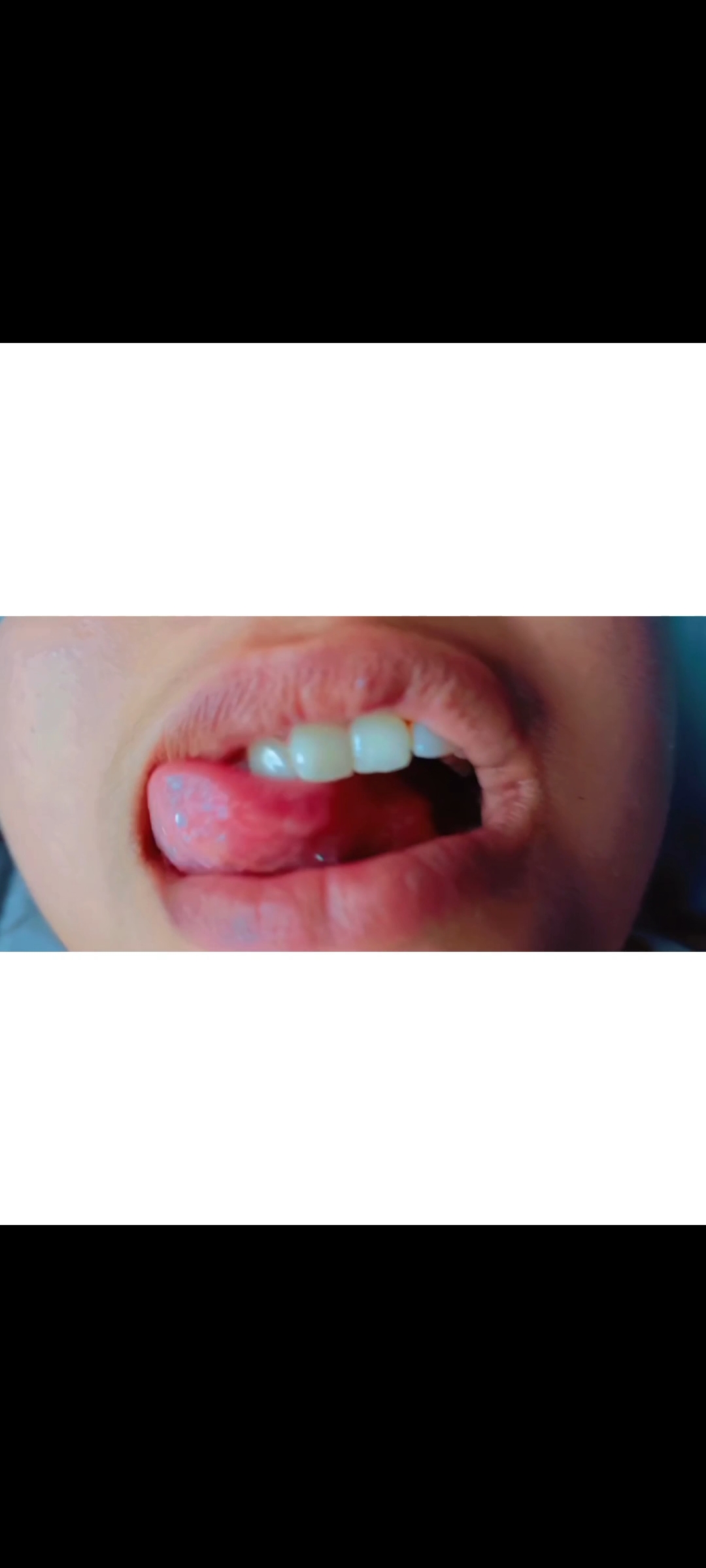 Like Share & comment