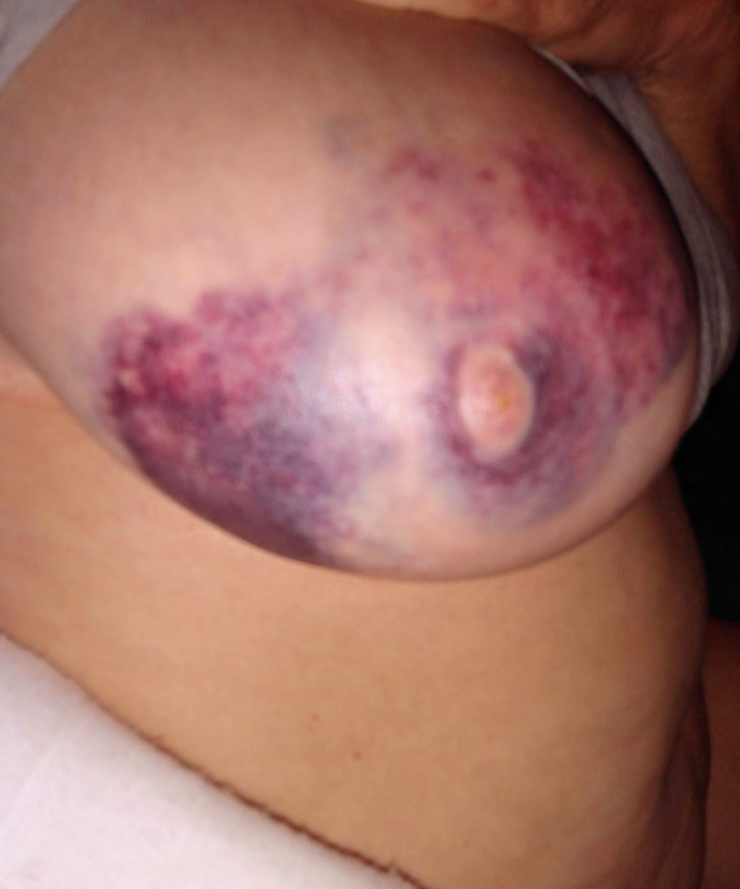 Hope Rene Yates 42D DOB 04.06.1994. SW Indiana 46787