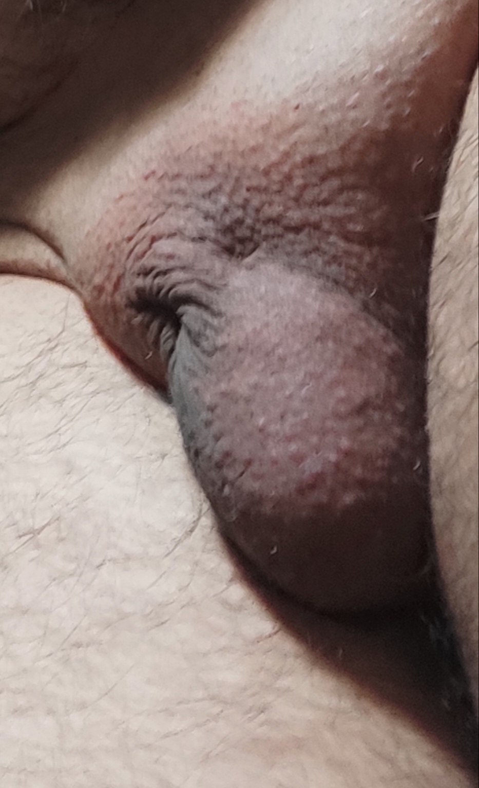 small penis