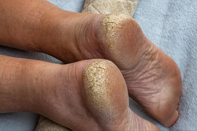 Foot fetish Feet Heels footjobs