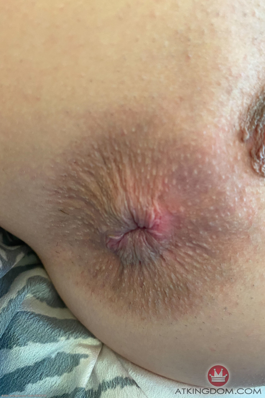 Girls showing their anus