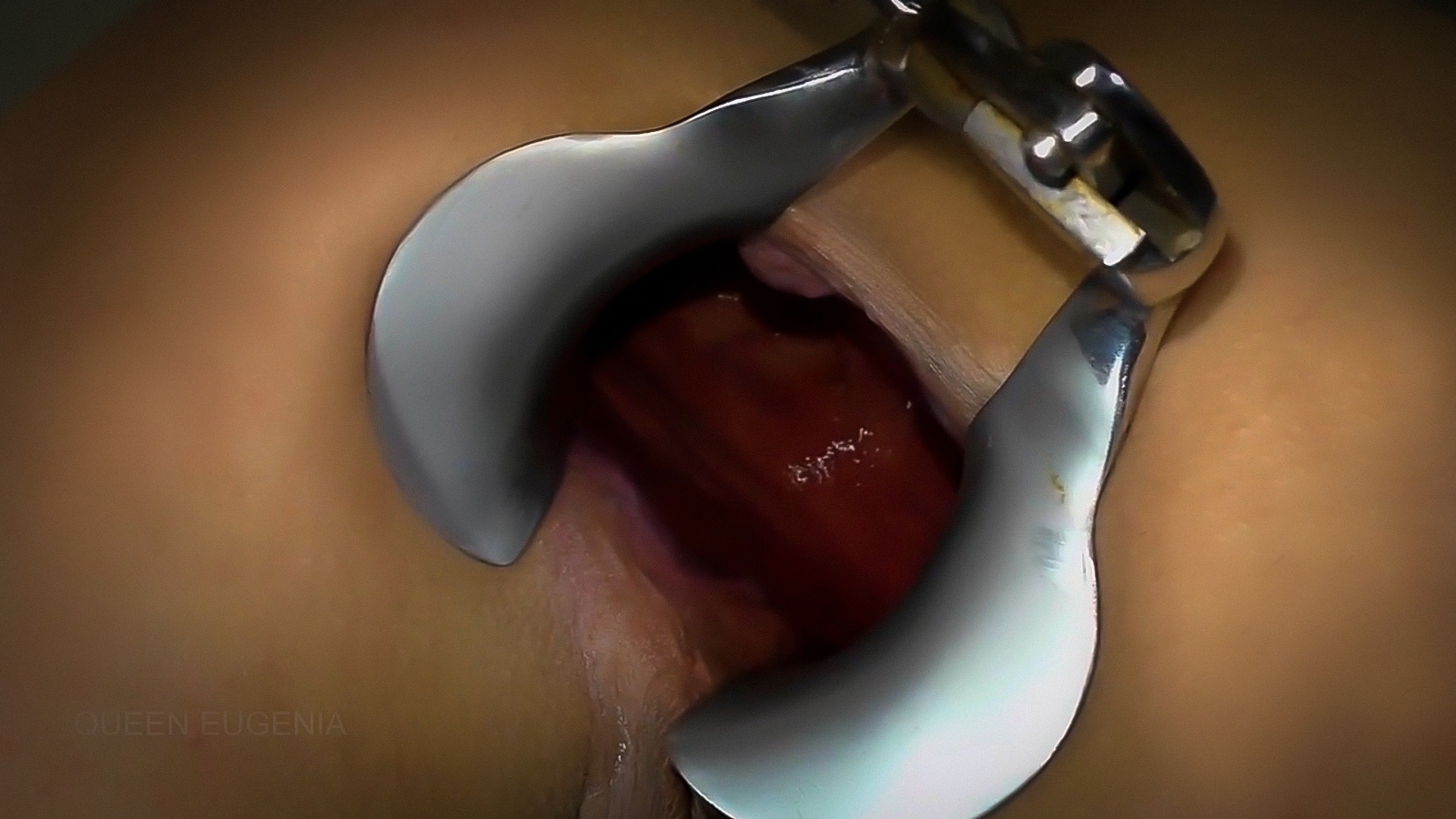 Queen Eugenia opens her ass wide open with a huge speculum