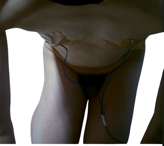 Attach electrodes to the nipples.