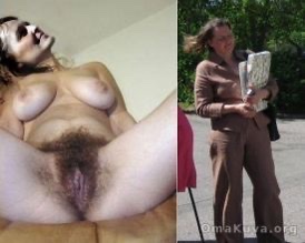 Hairy milf