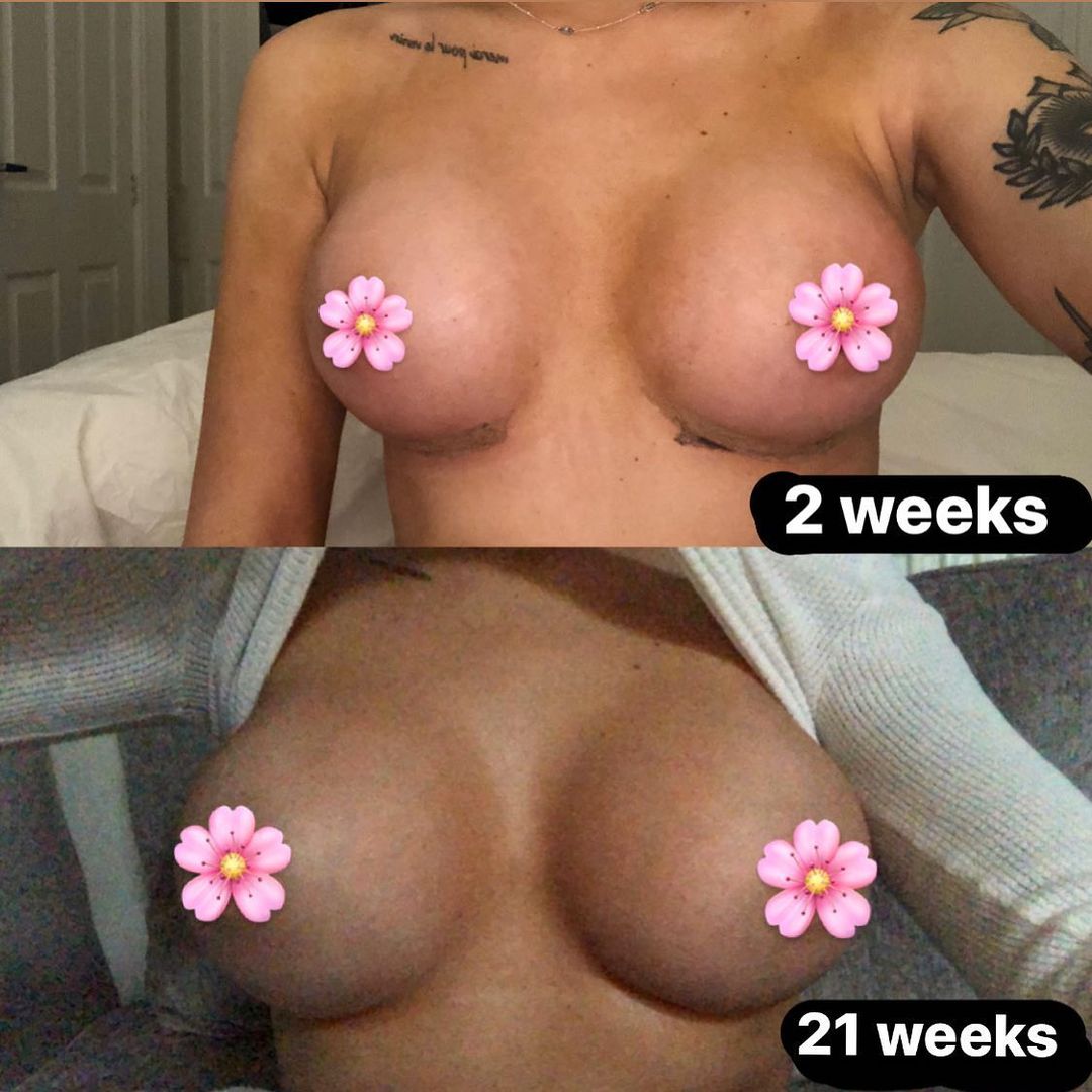 Liv.Jenkins Enhanced