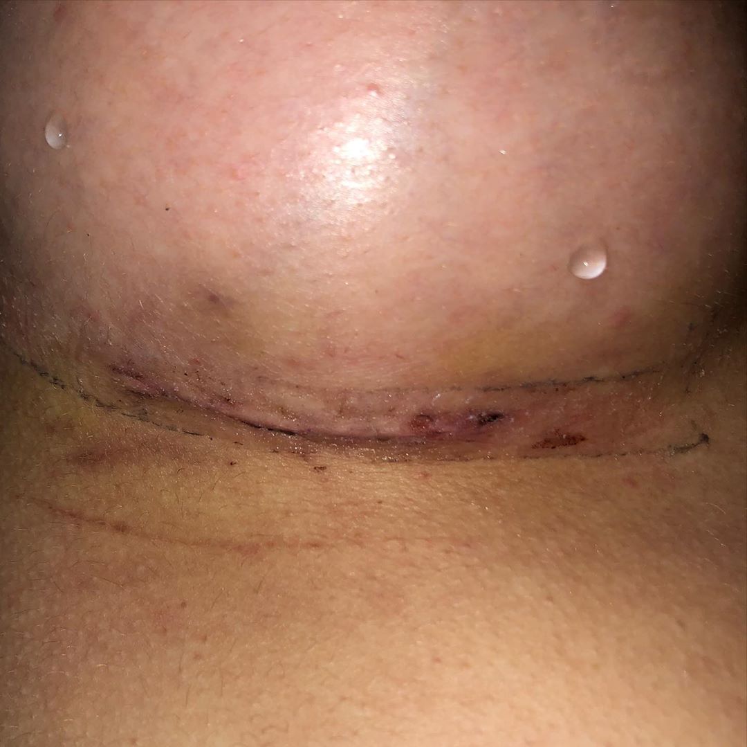 Liv.Jenkins Enhanced 2