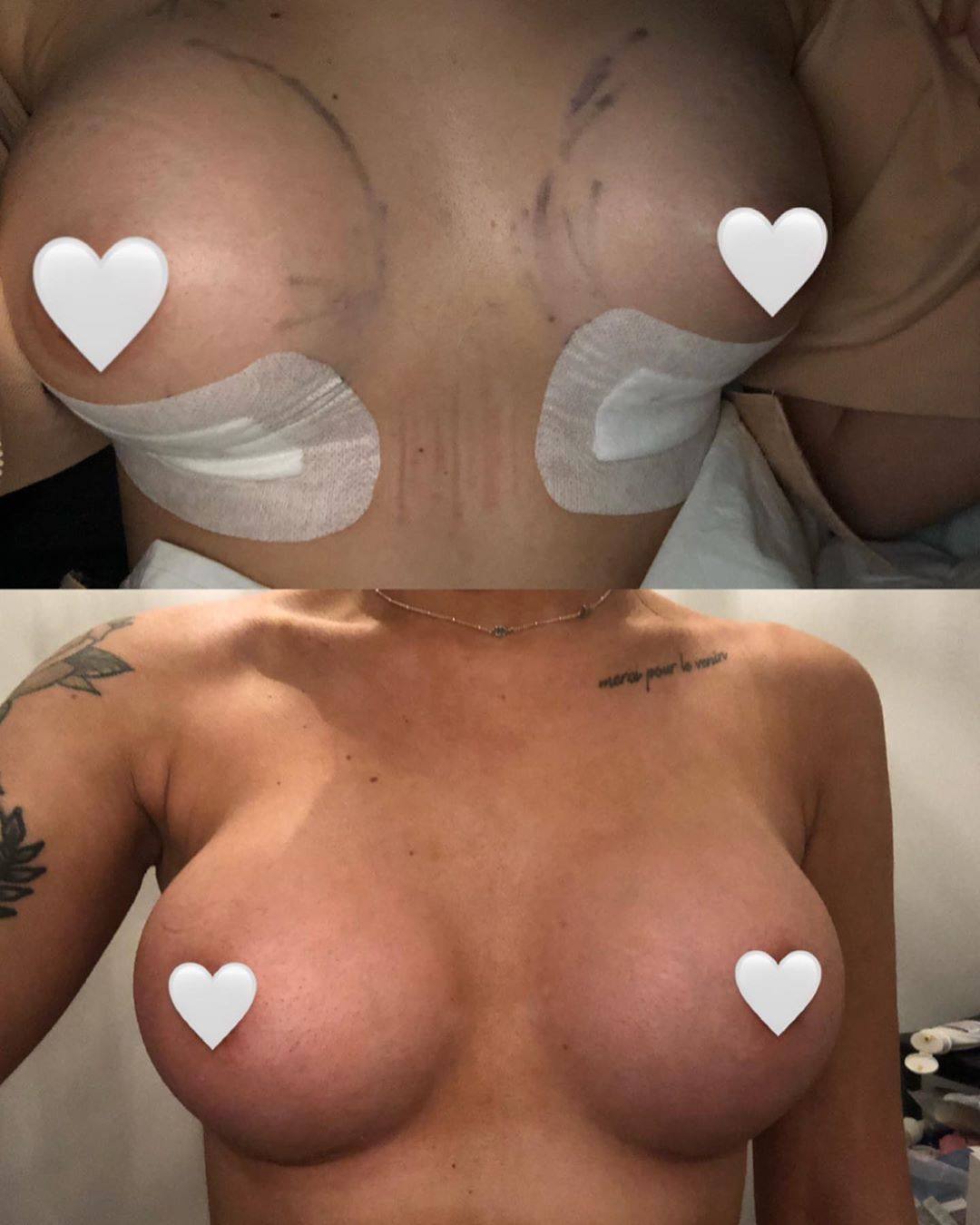 Liv.Jenkins Enhanced 2