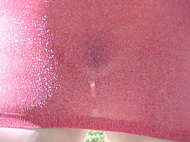 Kathy Sims from Salem oregon, Flashes