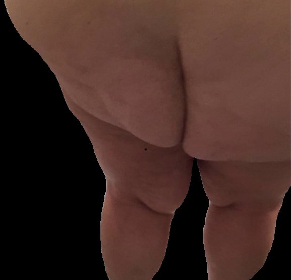 Denise Dube fat ugly ass