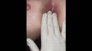 Mistress is Stretching his Ass