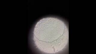 Watching Sperm with a Microscope(x500)!