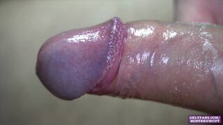 UNCUT COCK CLOSE UP (PEARLY PENILE PAPULES)
