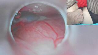 Japanese Mom Insemination Cum in Uterus and Endoscope Cam
