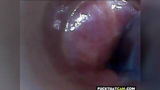 test tube cock endoscope POV urethral insertion ball rod