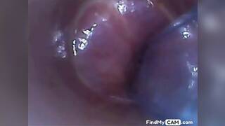 test tube cock endoscope POV urethral insertion ball rod