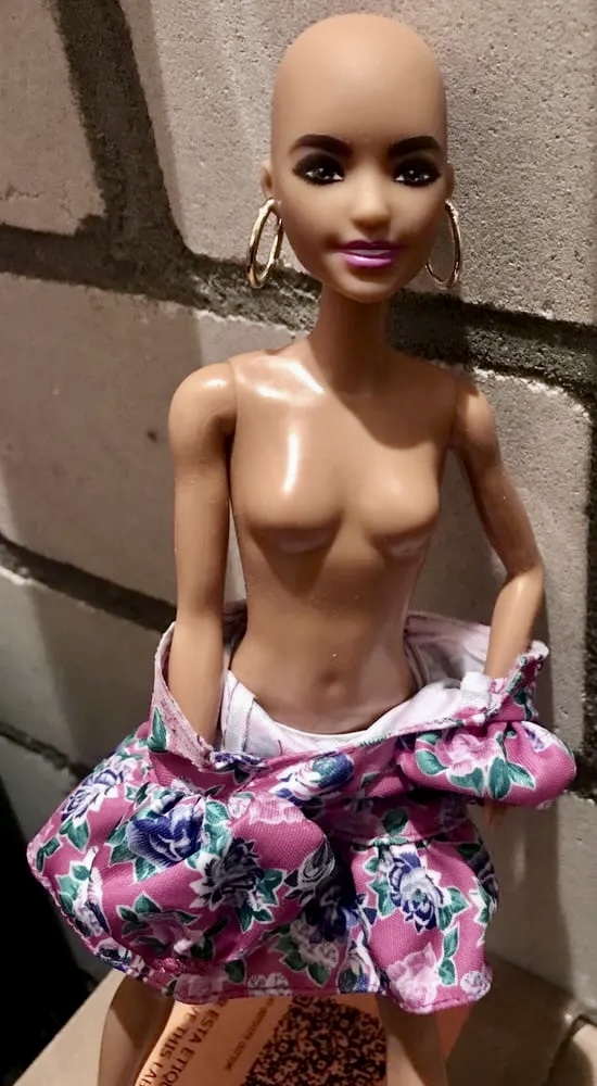 2021 bald Barbie Alopecia