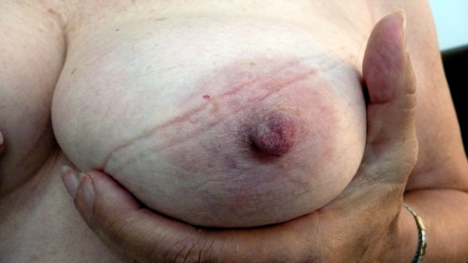 One boob photos since 2012.