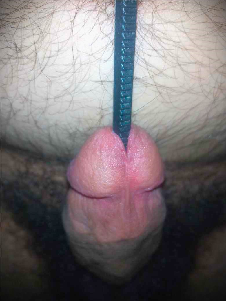 A long iron inside my penis