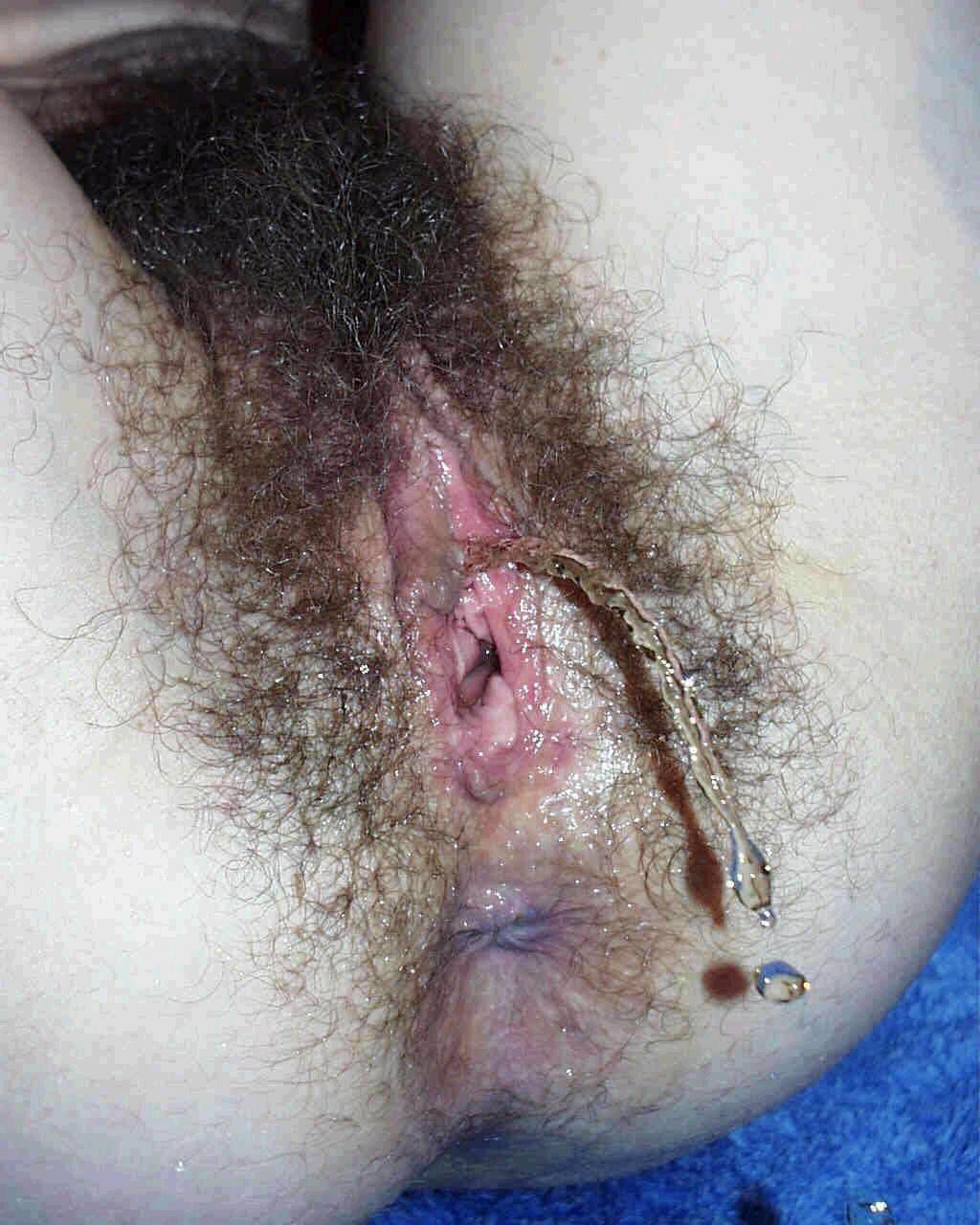 URO PISSING PEE