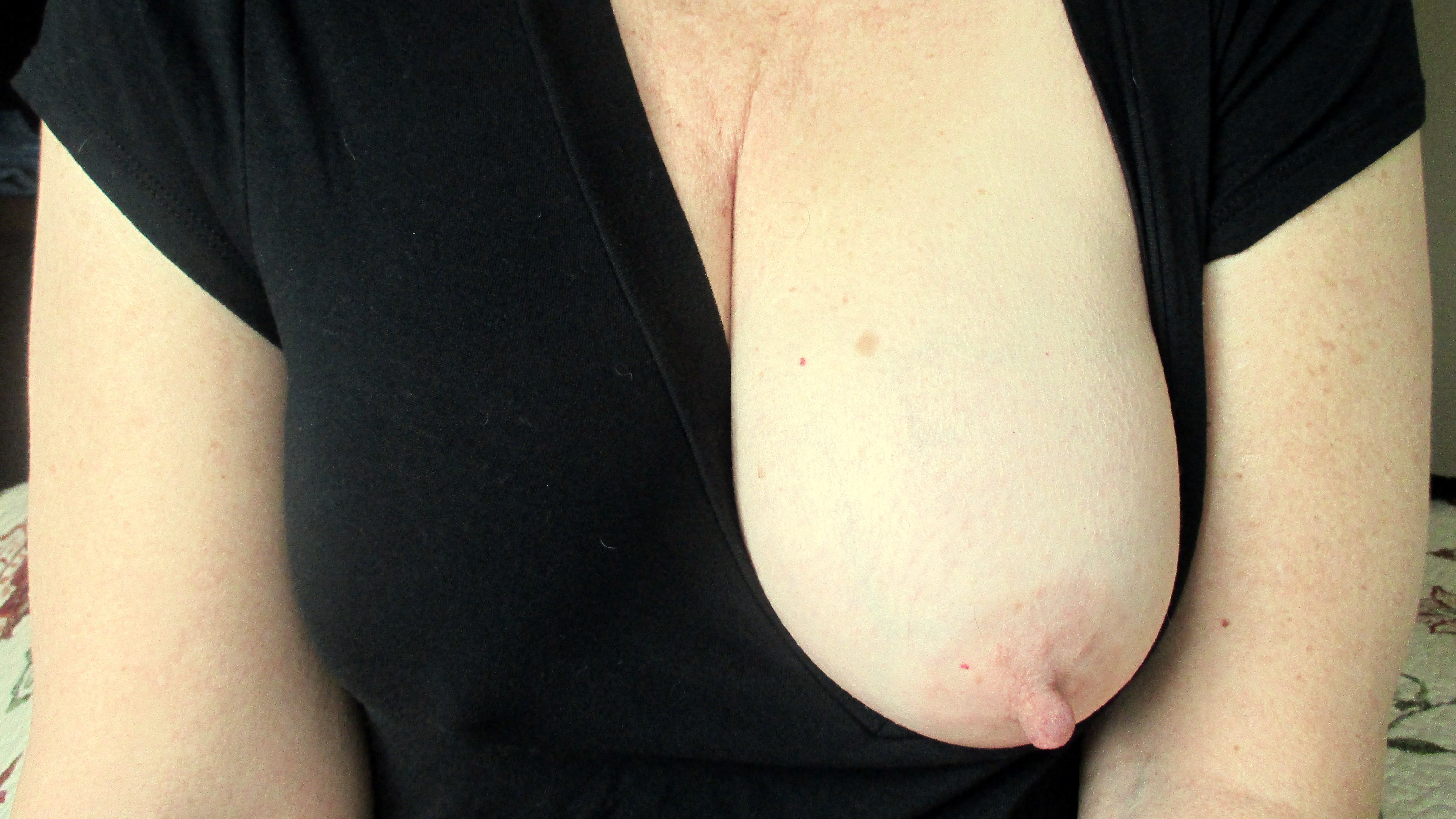 One boob photos since 2012.